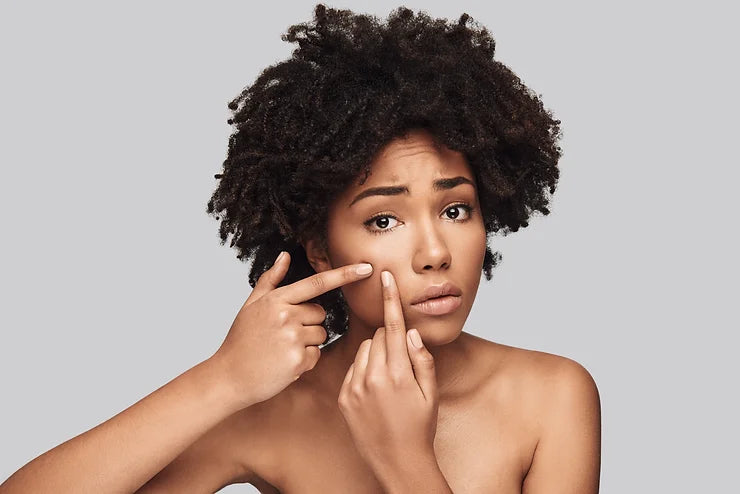 Healing Beyond the Surface: Navigating Postpartum Acne with Grace and Faith