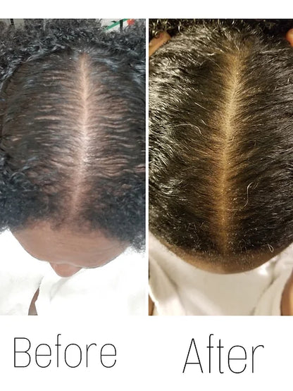 Hair Growth Serum