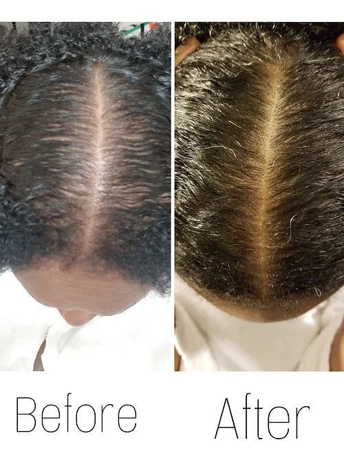 Hair Growth Serum